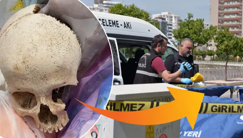 Sitenin Çöpünden Kafatası Çıktı: Uzman Doktorun Sırrı Ne?