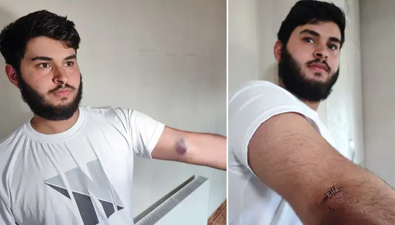 Bahçeye Kaçan Bir Top, Mahallede Neleri Değiştirdi?